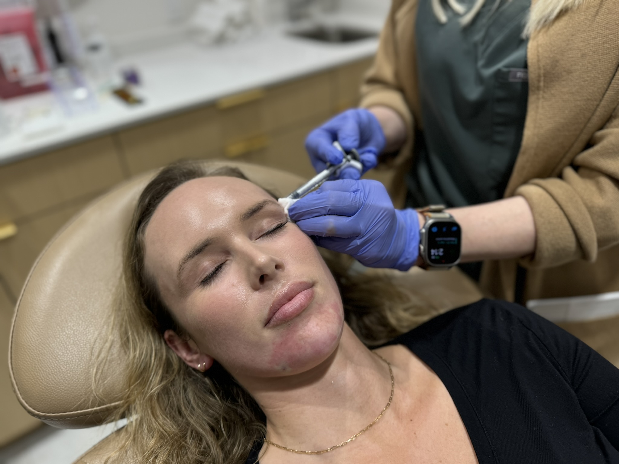 Dermal Fillers Carlsbad